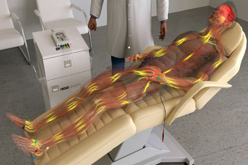 Imagen descriptiva del funcionamiento de la neuromodulación